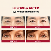 K-SECRET SEOUL 1988 Eye Cream | Korean Retinal Cream for Wrinkles, Brightening & Firmness | 30ml